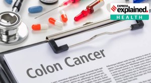 Explained: All you need to know about colon cancer