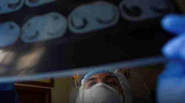 Doctor Samuel Gutierrez, part of the Ecuadorian health ministry's rapid response team for the coronavirus disease (COVID-19), looks at images of the lungs of an 81-year-old man who is suspected of having the disease, at the man's home in Guayaquil, Ecuador April 29, 2020. (Representational image: REUTERS/Santiago Arcos)