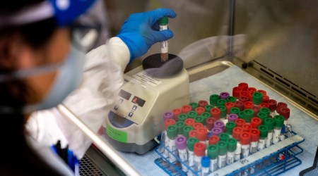 coronavirus, coronavirus test, coronavirus testing, coronavirus news, indian express