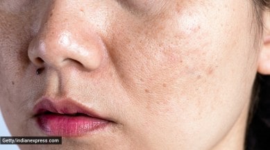 how to clean pores, pores on face, skincare routine, skincare tips, dr geetika mittal gupta, indianexpress, clogged pores,
