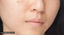 Cosmetologist shares tips to tighten your skin at home