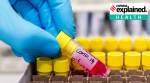 covid vaccine, coronavirus vaccine, covid vaccine India, India covid vaccine, Explained health, Express Explained, Indian Express