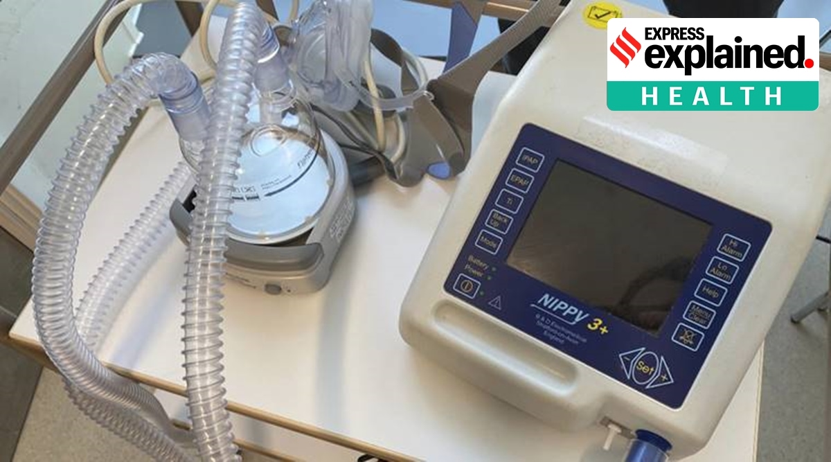 Although splitting ventilators can be inherently dangerous, the researchers say their model shows how some of the issues can be mitigated. (Representational Image)