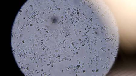 Cells containing the novel coronavirus SARS-CoV-2 are seen through a microscope at the Stabilitech laboratory in Burgess Hill south east England.   (Photographer: Ben Stansall/AFP/Getty Images)