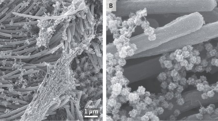 coronavirus, SARS-CoV-2, SARS-CoV-2 respiratory cells, coronavirus cells, coronavirus infecting lab-grown cells, world news, Indian Express