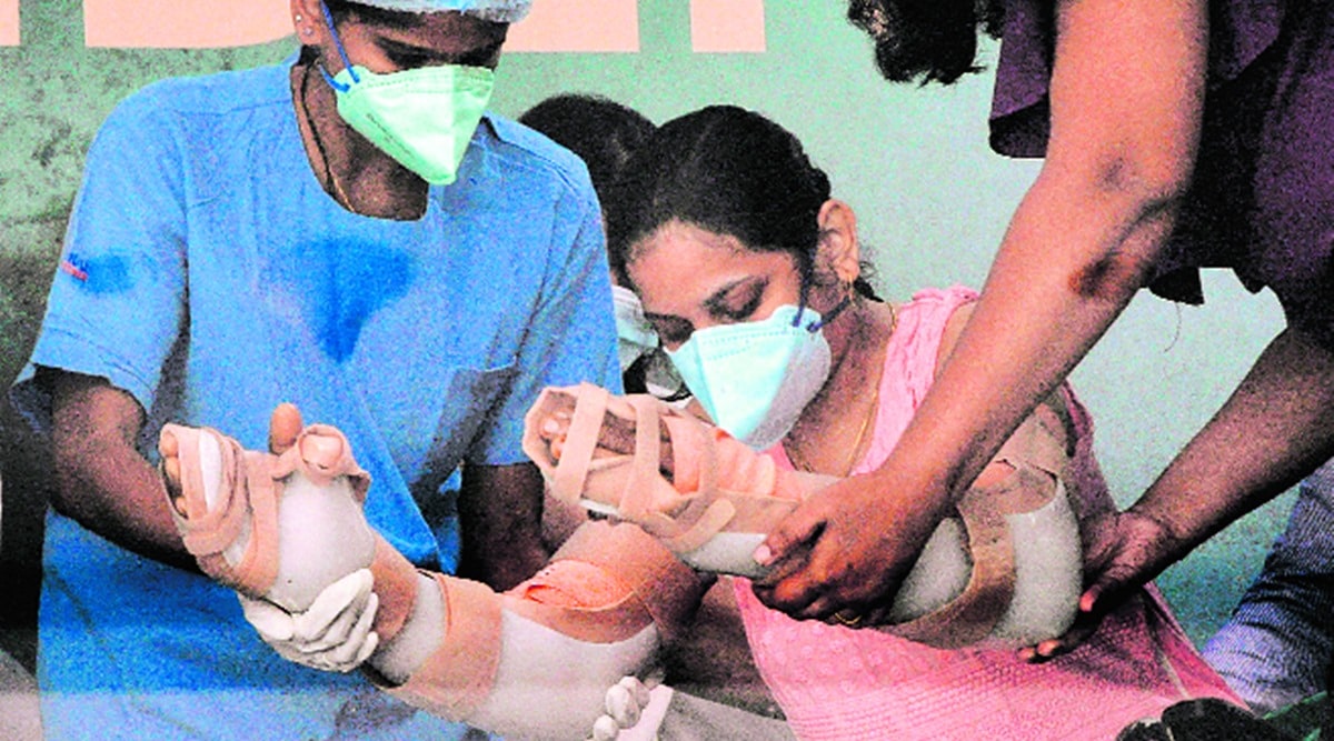Hand transaplant, mumbai first hand transplant, mumbai hand transplant surgery, manika more hand transplant, india hand transplant, mumbai news, indian express news