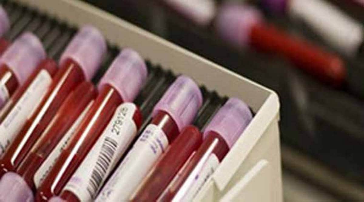 Haemophilia Treatment Centre, New Civil Hospital, Surat hospital struggles to survive, lack of funds, Surat news, Gujarat news, Indian express news