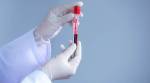 Mumbai blood shortage