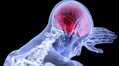 World Stroke Day 2020, World Stroke Day, Stroke Day, what causes stroke, what happens when you have a stroke, stress, health, indian express news