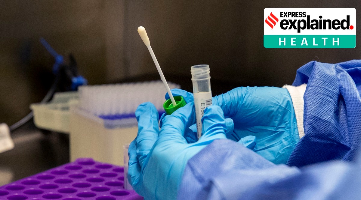 A medical laboratory assistant prepares Covid-19 tests for analysis in a laboratory at Whiston Hospital in Merseyside, Liverpool, England, Tuesday Oct. 20, 2020.  (Peter Byrne/PA via AP)