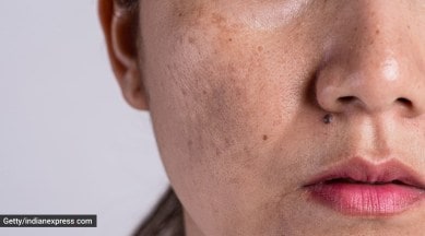 licorice powder benefits, indianexpress.com, skin care remedy, skincare tips, festive season skincare, indianexpress, pigmentation home remedy,