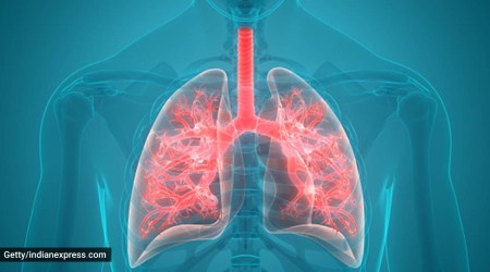 COPD day, world COPD DAY, what is COPD, Chronic Obstructive Lung Disease symptoms, Chronic Obstructive Lung Disease causes, Chronic Obstructive Lung Disease treatment, indianexpress, indianexpress.com