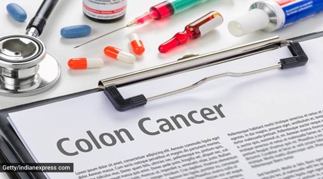 colon cancer, what is colon cancer, what causes colon cancer, colon cancer treatment, colon cancer screening, health, indian express news