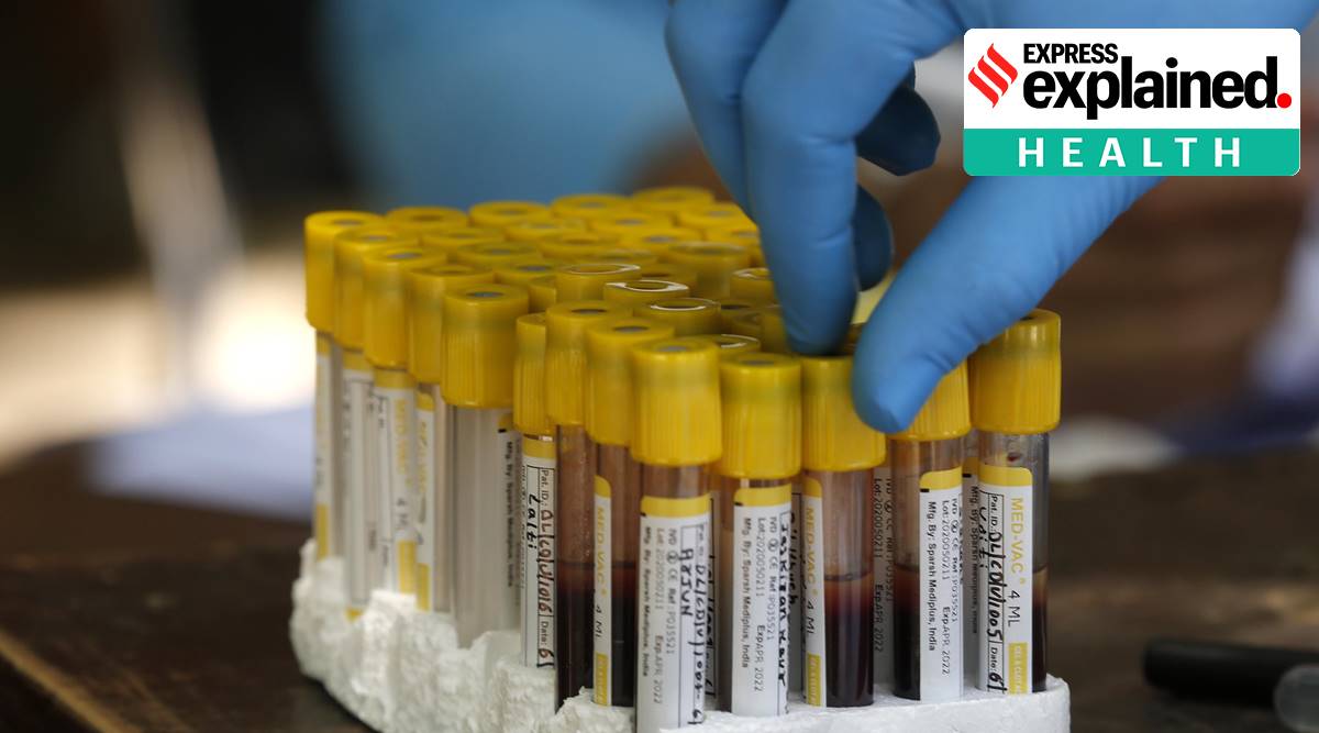 coronavirus, coronavirus antibodies, covid 19 vaccine, covid 19 survey pune, serum institute of india, covid 19 vaccine news, serum institute of india covid 19 survey, coronavirus vaccine news, coronavirus serm news, serm covid 19, serm coronavirus, serm today news