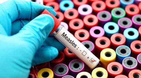 measles India cases, infant deaths, measles vaccine, Pune news, Maharashtra news, Indian express news