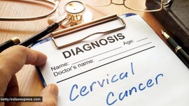 Cervical cancer, how to deal with cervical cancer, cervical cancer symptoms, cervical cancer prevention tips, how to prevent cervical cancer, indianexpress.com, indianexpress,