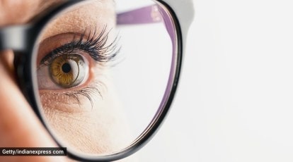 Refractive Surgeries In Al