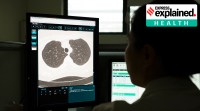 A doctor looks at CT scans of a patient’s lungs at the Zhejiang Provincial People’s Hospital in Hangzhou. no alt set