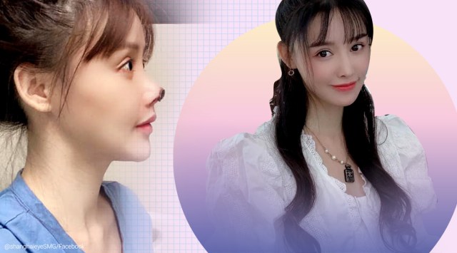 Chinese star Gao Liu nose surgery, plastic surgery, Plastic surgery gone wrong, nose job gone wrong, botched nose job, china plastic surgery trending, Weibo, indian express news