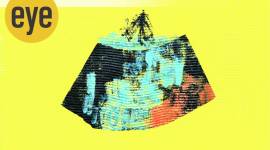 inclusive society, World Autism Day, differently abled, eye 2020, sunday eye, indian express news