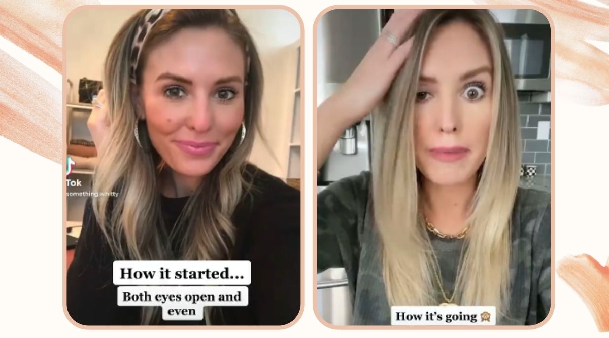 Chicago, Chicago blogger, Chicago blogger botched Botox, Whitney Buha blogger Chicago, medical spa, botox eye, drooping eye, trending, indian express, indian express news