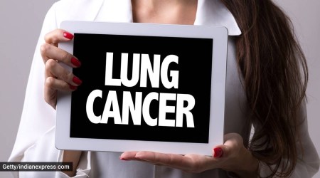 cancer screening, cancer cure, cancer detection, detection center, indianexpress.com, indianexpress, lung cancers, tobacco usage, lung cancer screening, cancer therapy,