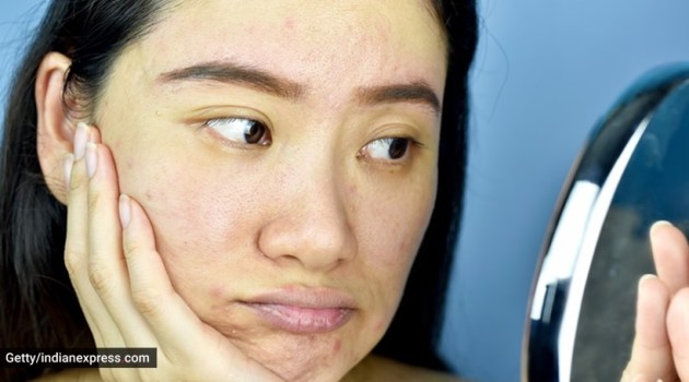 skincare