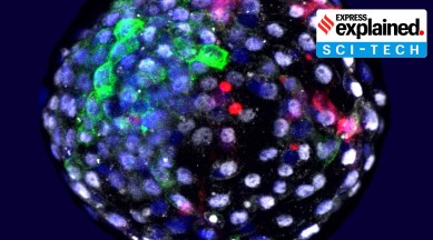 Human-Monkey chimeric embryo