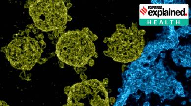 covid-19, covid-19 cases in india, sars-cov-2, coronavirus infection, University of Oldenburg, coronavirus close up, coronavirus photograph, india news, indian express