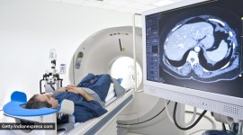 Cancer symptoms, cancer cure, cancer treatment, radiation therapy, is radiation safe, cancer India, indianexpress.com, indianexpress,