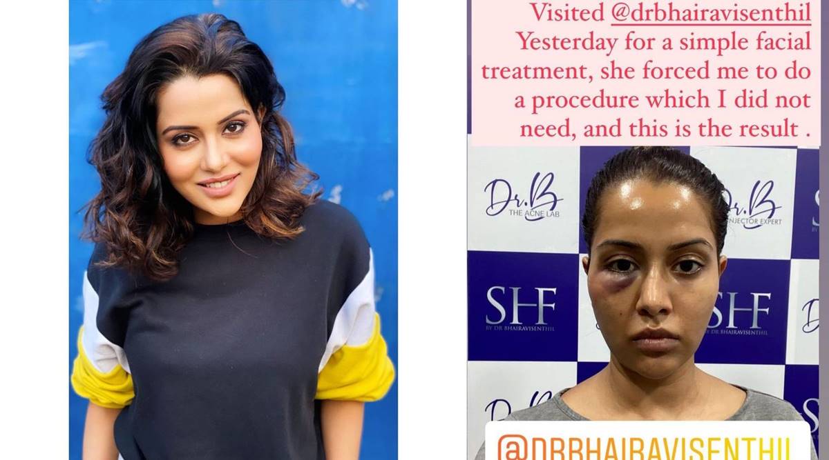 Raiza Wilson Sex - Raiza Wilson's facial treatment goes wrong, slams dermatologist for forcing  her into it | Entertainment News,The Indian Express