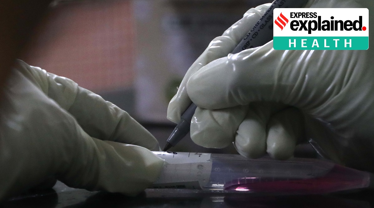 A sample is taken from a person for Covid-19 testing in Kolkata. (Express Photo: Partha Paul)