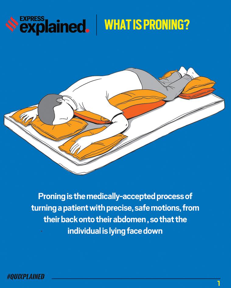 Quixplained The importance of proning during Covid19 pandemic