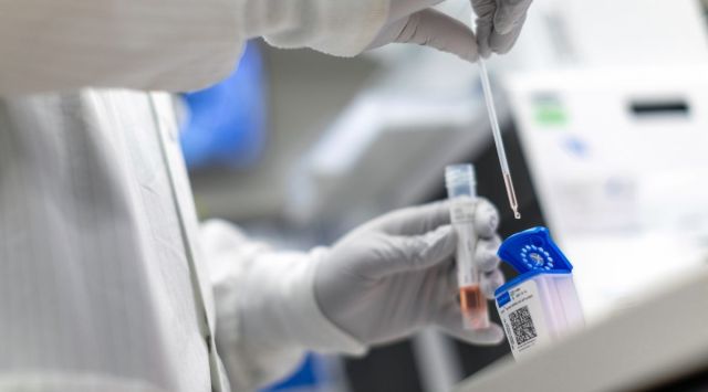 An undated photo provided by Sanford Health shows a quad test used by the Sanford Health System in South Dakota. The test looks for multiple pathogens with a single sample. (Sanford Health via The New York Times)
