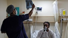 A doctor checks an X-ray of a patient suffering from the coronavirus disease (COVID-19) inside a COVID-19 ward of a hospital in New Delhi no alt set