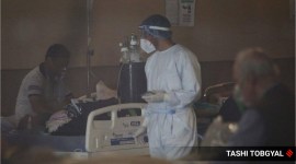 yellow fungus, yellow fungi, yellow fungus symptoms, prevention yellow fungus, fungal infections and prevention, indianexpress, indianexpress.com