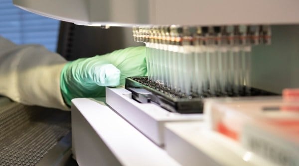 biogen alzheimer, biogen alzheimer drug, biogen alzheimer drug fda, biogen alzheimer drug approval, biogen alzheimer drug approval fda, alzheimer disease, alzheimer disease treatment