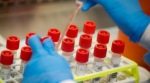 Traces of SARS-CoV2 detected in Pune’s wastewater