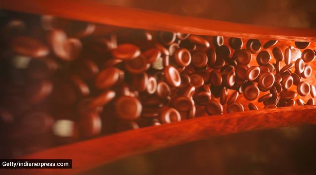 Covid clots, artery clots caused during Covid-19, Covid-19 and artery clots, what you need to know about clots in the arteries, indian express news