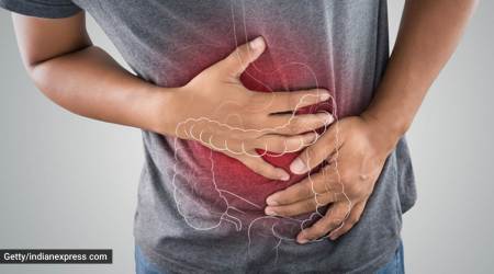 COVID-19, Intestinal gangrene in Covid, what is intestinal gangrene, what causes intestinal gangrene, intestinal gangrene symptoms and treatment, indian express news