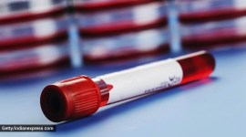 Ferritin value, Ferritin test, Ferritin blood test, indianexpress.com, indianexpress, Ferritin symptoms, Ferritin iron levels, iron deficiency,