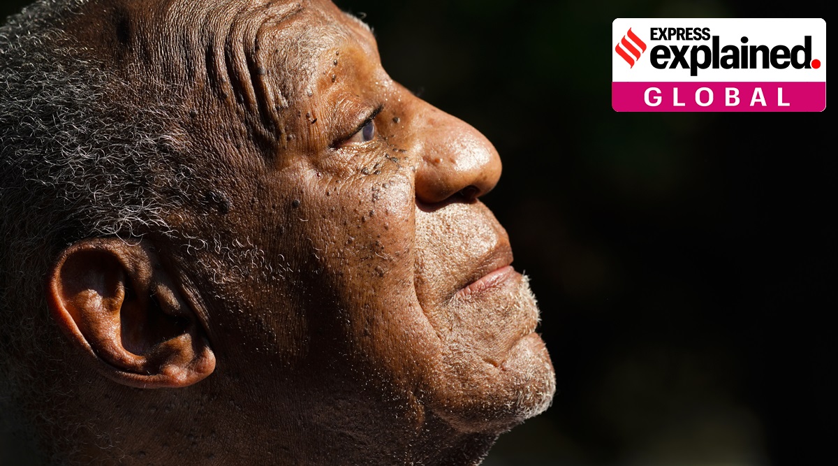 Bill Cosby listens to members of his team speak during a news conference outside his home in Elkins Park, Pa., Wednesday, June 30, 2021, after being released from prison. (AP Photo/Matt Rourke)