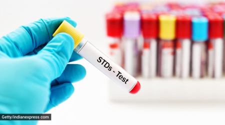 sexually transmitted diseases, STDs, what are sexually transmitted diseases, what causes sexually transmitted diseases, sexually transmitted diseases and infections, sexually transmitted diseases and infertility, STD and infertility, indian express news, parenting