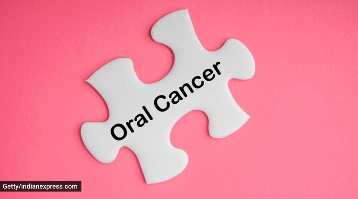oral cancer, what is oral cancer, what causes oral cancer, poor oral hygiene and oral cancer, the importance of oral hygiene, indian express news