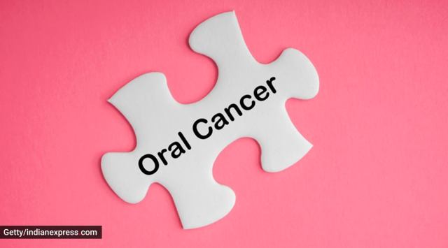 oral cancer, what is oral cancer, what causes oral cancer, poor oral hygiene and oral cancer, the importance of oral hygiene, indian express news