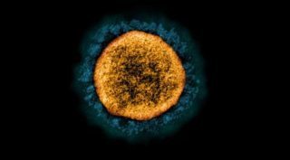 Transmission electron micrograph of a SARS-CoV-2