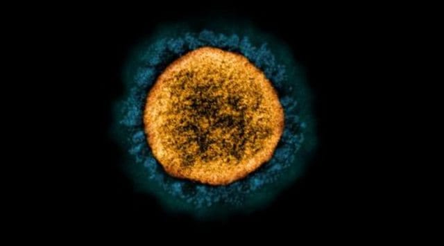 Transmission electron micrograph of a SARS-CoV-2