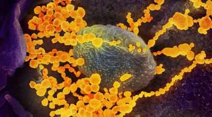 AI helps identify existing drugs that can kill SARS-CoV-2 