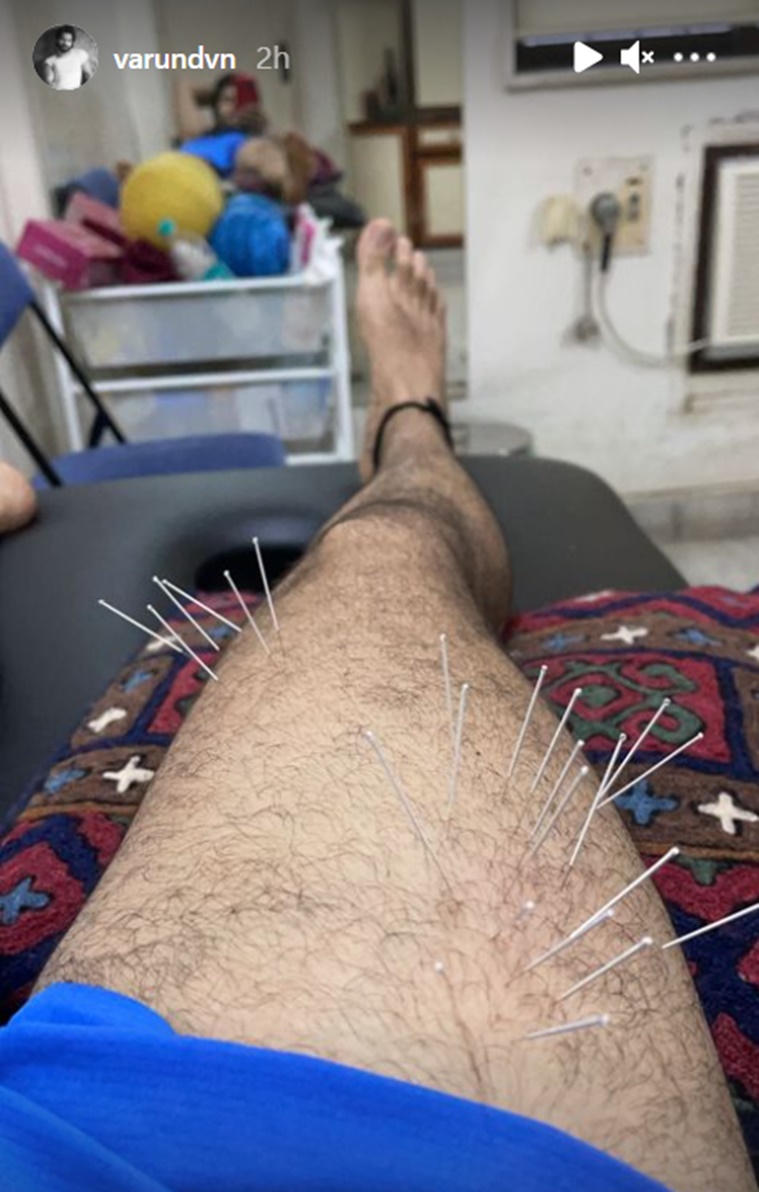 dry needle therapy, what is dry needling, how to manage pain, dry needle for pain, varun dhawan news, varun dhawan dry needle therapy, indianexpress.com, indianexpress, 