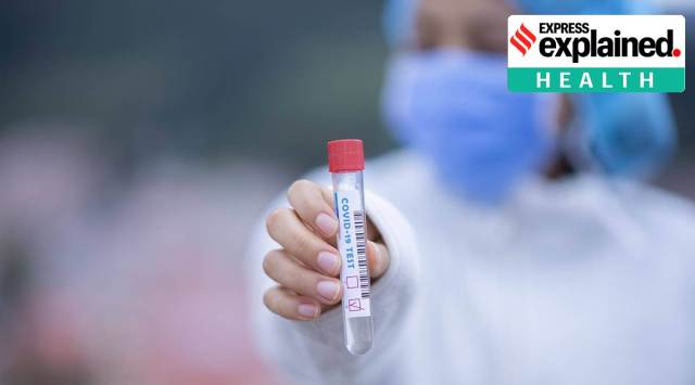 The researchers used an agent made by the lab supply company Bio-Rad called ‘Chelex 100 resin’ to preserve SARS-CoV-2 RNA in samples for detection by RT-qPCR. (File photo)